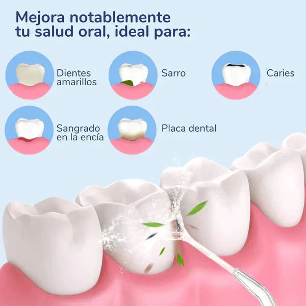 AquaSmile™ | Irrigador Bucal Recargable Limpieza Dental Profunda