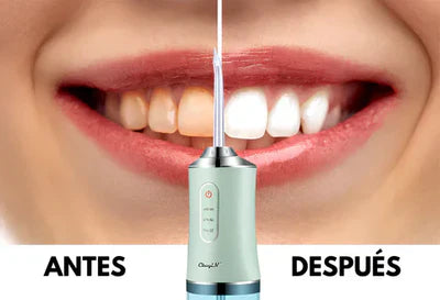AquaSmile™ | Irrigador Bucal Recargable Limpieza Dental Profunda